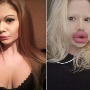 The Woman With the World’s Biggest Lips: Andrea Ivanova’s Unstoppable Journey of Transformation
